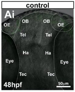 olfactory bulb in control conditions